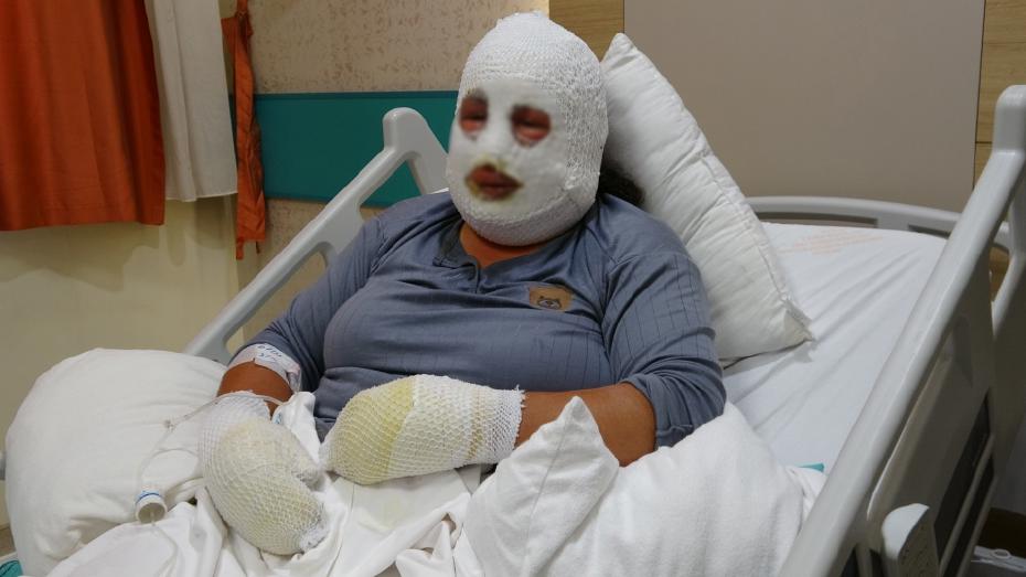 Ardahan'da yangın kabusu: 6 yaşındaki kızını alevlerin arasından böyle kurtardı