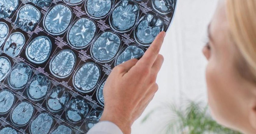 Beyin Sağlığı Uzmanından Yararlı Beslenme Önerileri