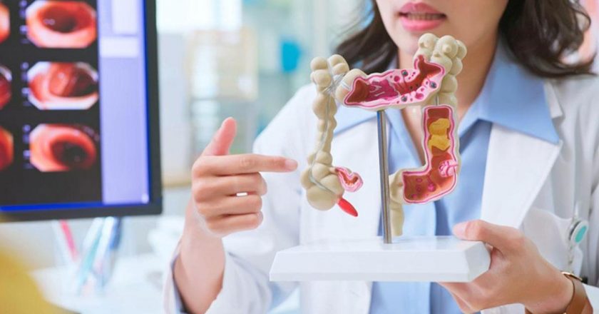 Casso bağırsak görevi nedir? Akıllı bağırsak fonksiyonları ve özellikleri nelerdir?