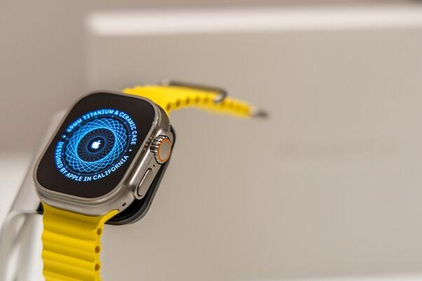 2026 Apple Watch serisi için dikkat çeken iddialar: Son yılların en büyük yükseltmesi olabilir