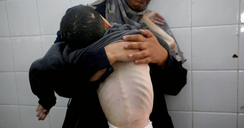 Soykırımcı İsrail’in kıtlığı dayattığı Gazze’de 4 kişi daha açlıktan hayatını kaybetti